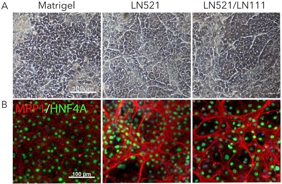 LN521和LN111与Matrigel对比培养24天的hESC-肝细胞相差及MRP1/HNF4A蛋白表达水平的免疫荧光染色代表性图像
