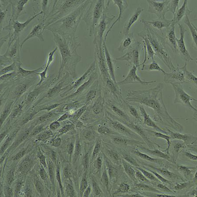 图2.人肝星状细胞（Hepatic Stellate Cells, HSCs）