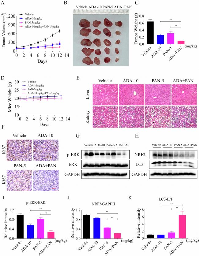 Fig. 10: ADA can cooperate with PAN to inhibit tumor growth in vivo.