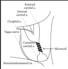 ΢�͵���ȦMicrocoil/��΢����Ȧ/΢����Ȧ