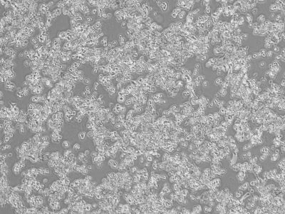 Ke39 KE-39_人胃癌细胞_报价/价格/性能参数/图, 格宁生物_生物器材网