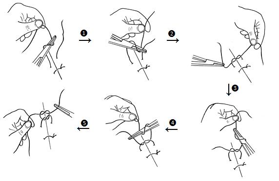 连续缝合打结方法图解图片