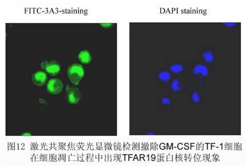 常用的几种细胞凋亡检测方法详细步骤介绍 中国生物器材网