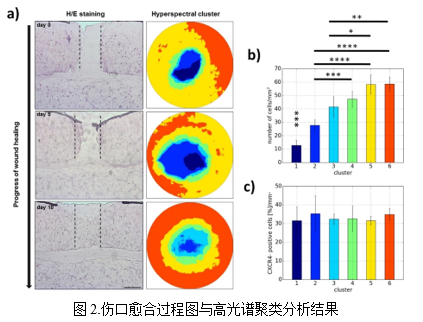 光谱成像技术创新应用SpectrAPP高光谱成像技术监测伤口愈合过程