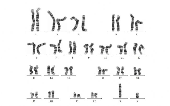 iPSC-EGFP-KIϸ��ģ��