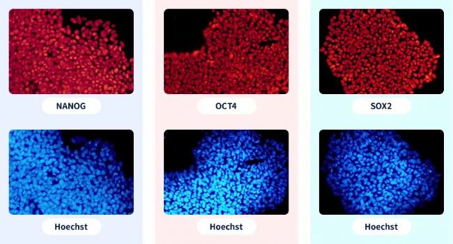 iPSC-EGFP-KIϸ��ģ��