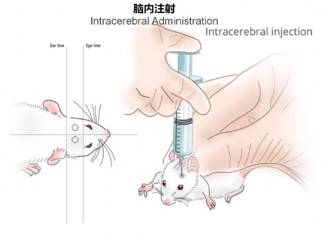 神经疾病CRO服务