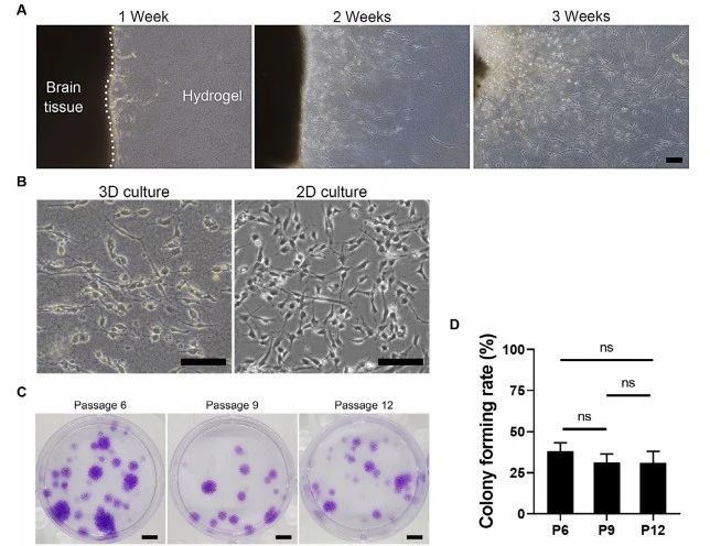《Acta Biomater》：3D培养神经干细胞球状体薄片移植改善脑损伤