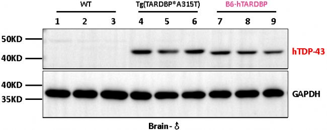 B6-hTARDBPС��