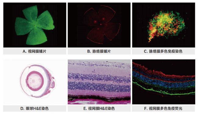 眼科疾病模型及其应用研究