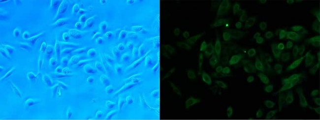 图2.Epithelix肺泡ATI细胞表征。左图:相差显微镜图像。右图:Aquaporin 5(ATI,肺泡1型细胞)阳性。