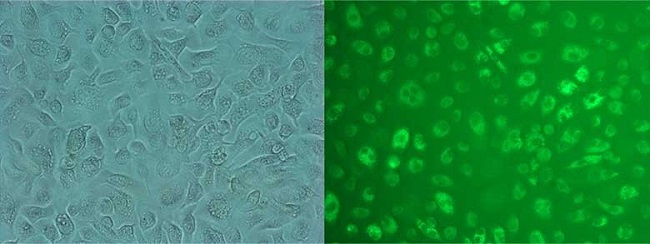 图3:Epithelix肺泡ATII细胞表征。左图:相差显微镜图像。右图:LysoTracker Green DND-26(ATII,肺泡细胞2型)阳性。