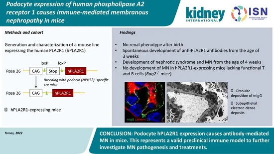 hPLA2R1自发模型-南模生物