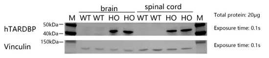 Detection of hTARDBP expression in hTARDBP-A315T mice by WB.