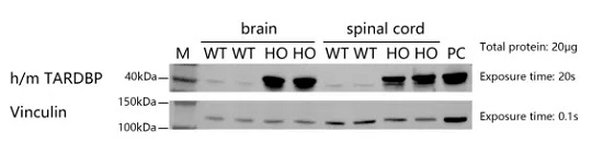 Detection of hTARDBP expression in hTARDBP-A315T mice by WB.