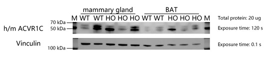 Detection of ACVR1C expression in hACVR1C(3) knockin mice by WB.-南模生物