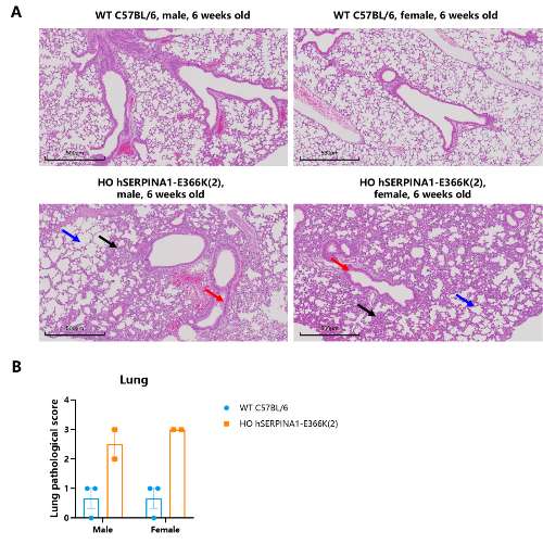 WT小鼠和hSERPINA1-E366K(2)小鼠(雄/雌)肺组织代表性H/E染色病理切片(A)和肺组织病理评分(B)