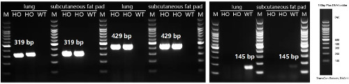 Detection of TGFBR2 expression in subcutaneous fat pad and lung by RT-PCR-��ģ����