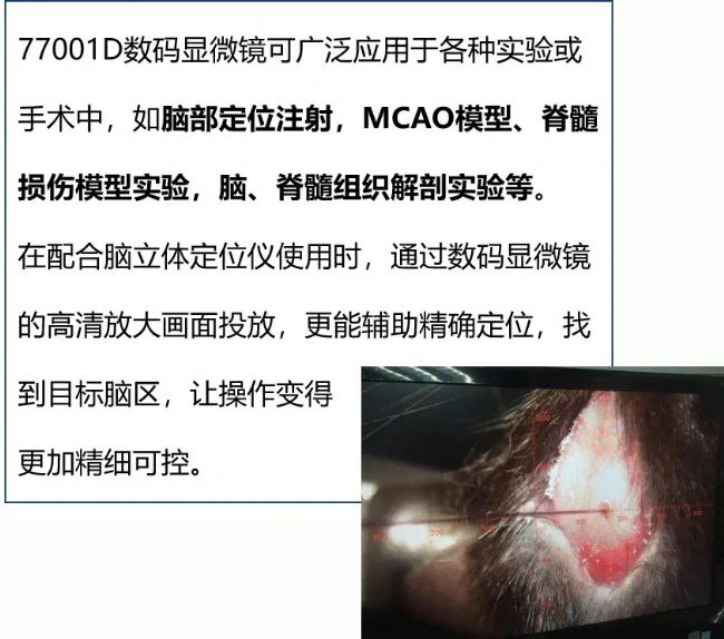 数码显微镜价格